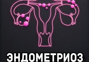 Эндометриоз