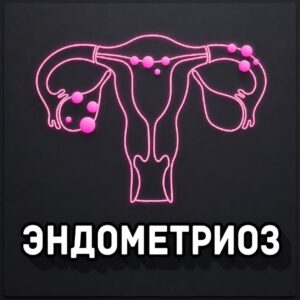 Эндометриоз